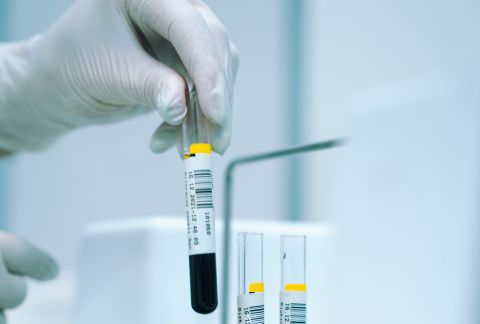 Не только водителям: как изменятся проверки на алкоголь и наркотики с осени