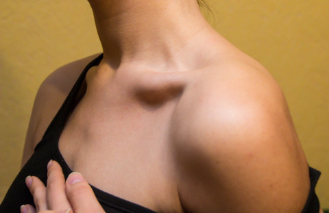 Озвучена главная причина смерти российских женщин